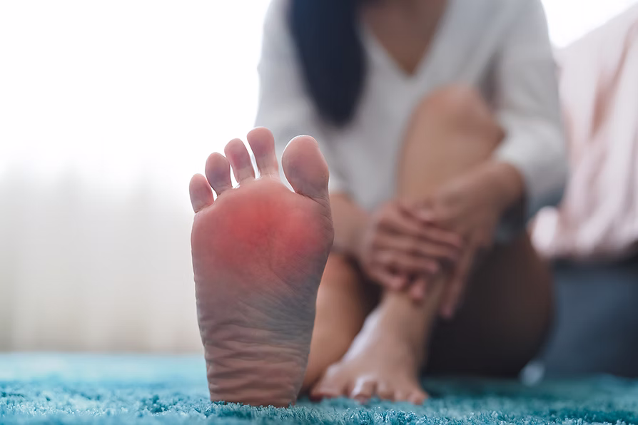 激光治療雞眼，解決足部痛楚