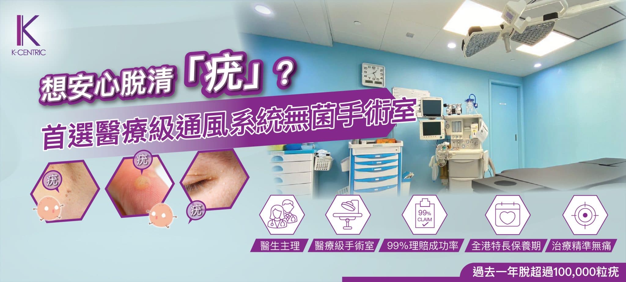 激光灰甲治療過程示意圖