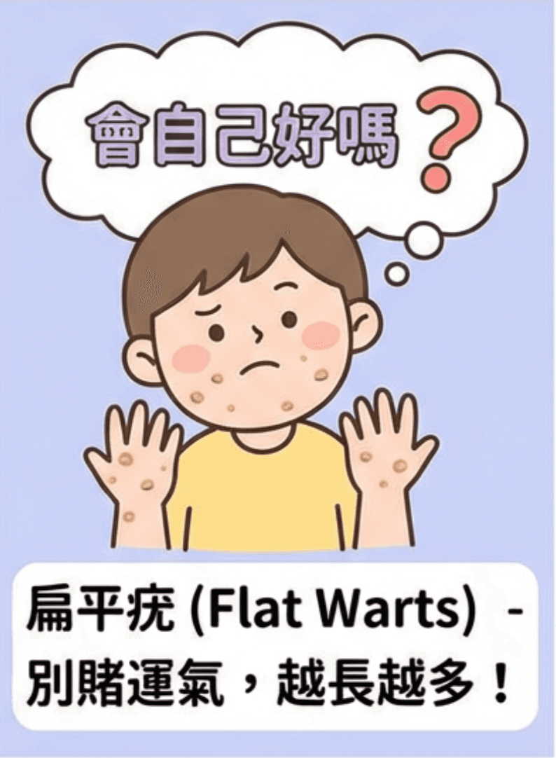 扁平疣會自己好嗎