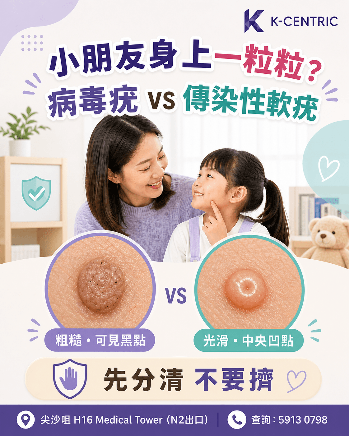 小朋友病毒疣與傳染性軟疣分辨指南,展示粗糙黑點與光滑中央凹點的外觀線索