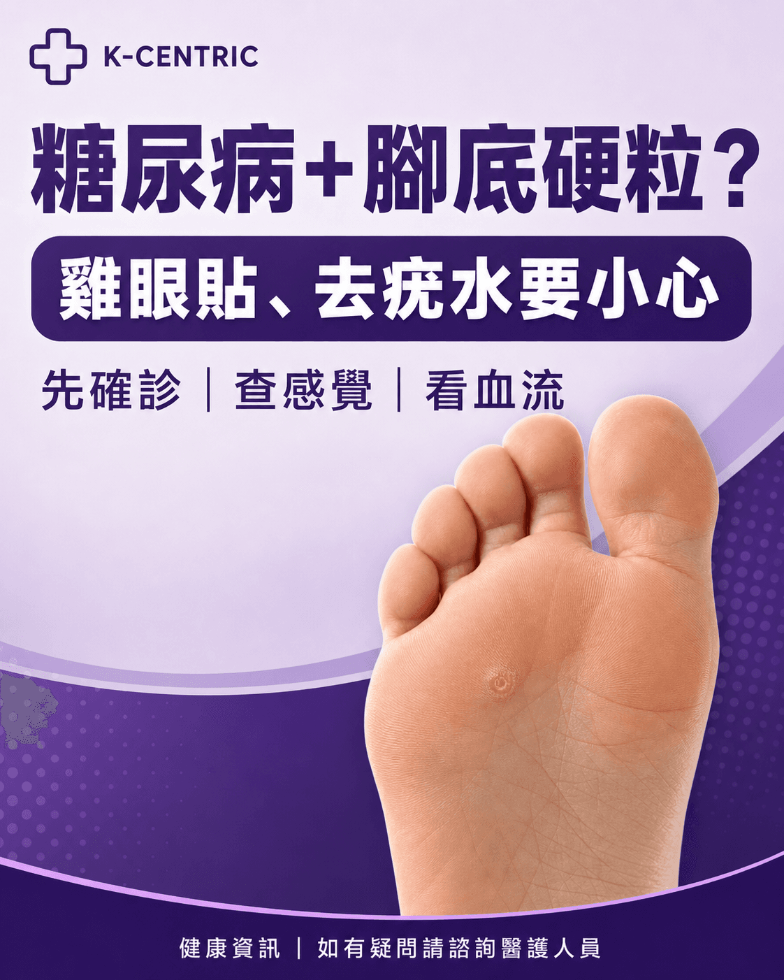 糖尿病患者腳底有硬粒時不應自行使用雞眼貼或去疣水的安全提醒